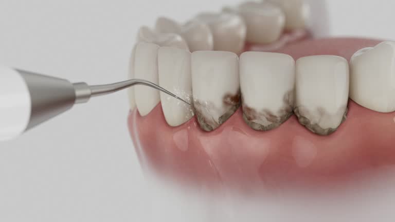 Reliable Dental Implants contractor in Edinburgh, IN by Smile Center Dentistry